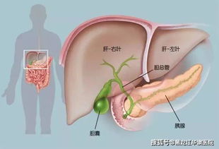 黑龙江华澳医院外科篇 普外科特色诊疗技术 无痛微创保胆取石术