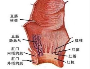 直肠癌发作的症状有哪些呢 