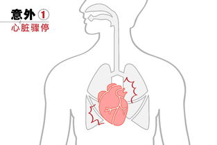 生活中必备的急救常识(日常生活中的急救小常识)