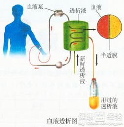 血液透析病人伴随眼底出血是什么原因