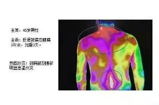 了解TMT红外热成像扫描原理