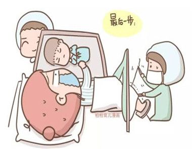 分娩，常用的分娩方法