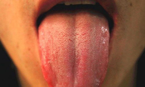 不建议刮舌苔的原因有哪些(为什么刮舌苔不好)