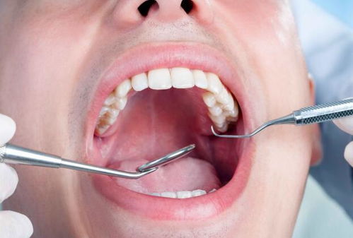 牙痛不算病,却让人难忍受 5种不同类型的牙痛,止痛方法也不同