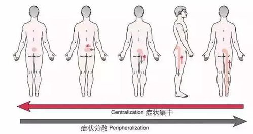 这样坚持十天,腰难再 突出