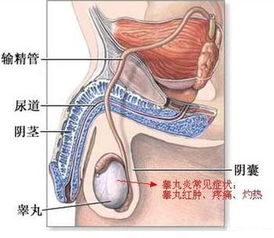 睾丸疼怎么办 