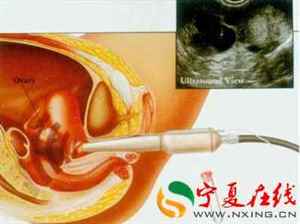 受精 受孕的全过程