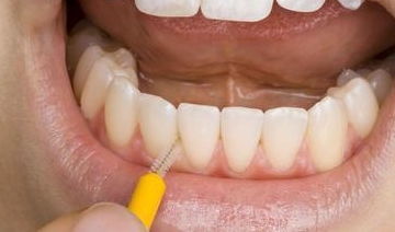 牙齿松动怎么办,3种方法预防牙齿松动,避免受伤