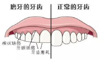 宝贝磨牙 只知道 打虫 你就out啦