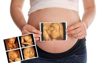 六个月胎儿彩超 帮我看看正常是否胎儿的大小