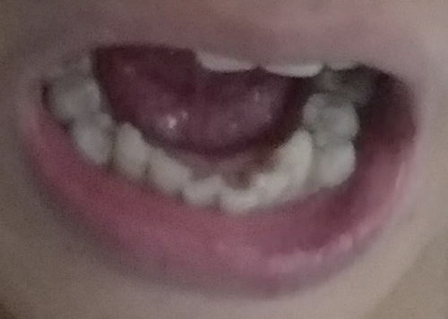 请问影响我嘴凸的原因是因为我的牙吗 