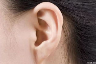 警惕 耳垂上有这道折痕,可能是冠心病的征兆