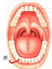 左后牙疼痛两天了,牙痛,左下后牙进食时疼痛半个月