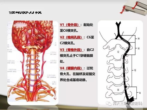 不建议头颈部cta操作流程