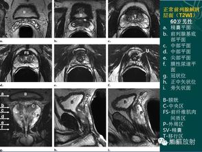 mri和nmr,MRI: MRI的基本原理。