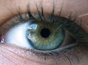 青光眼是什么 青光眼是什么原因引起的
