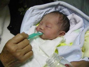 新生儿肺炎的防治 