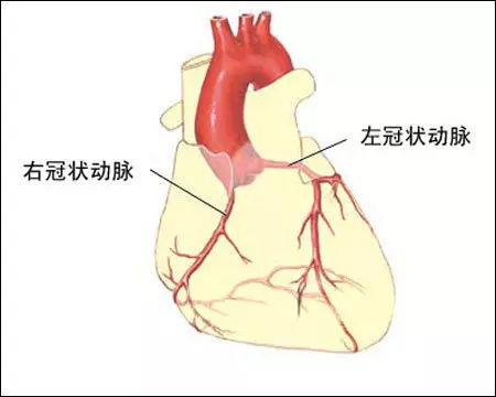 装了心脏支架后,能做核磁共振吗