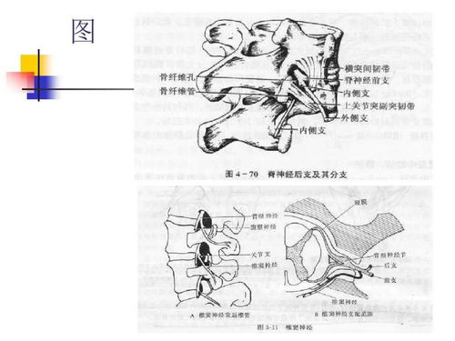 针刀治疗腰椎间盘突出症