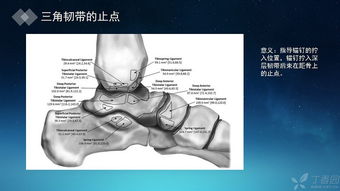 分享一例内踝三角韧带深层 浅层的修复