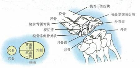 尺切迹位于什么骨 