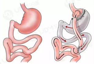 胃在哪个部位,胃在哪个部位图片
