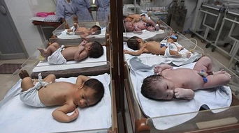 外媒 全世界每天100多万名婴儿出生第一天死亡