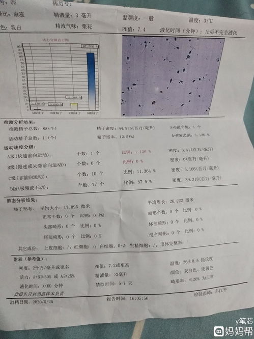 终于说服老公去检查了下 医生说一次说