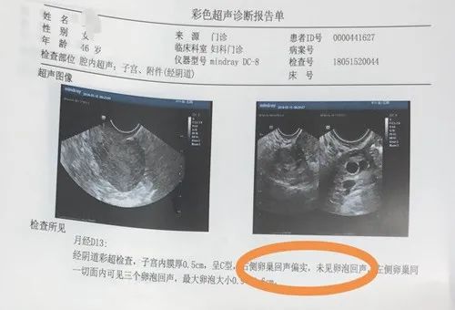 35岁如果被诊断卵巢早衰，要是试管失败，还有必要坚持婚姻吗(29岁卵巢早衰绝经试管)