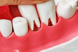 模拟牙齿清洁测试 个人护理评测 