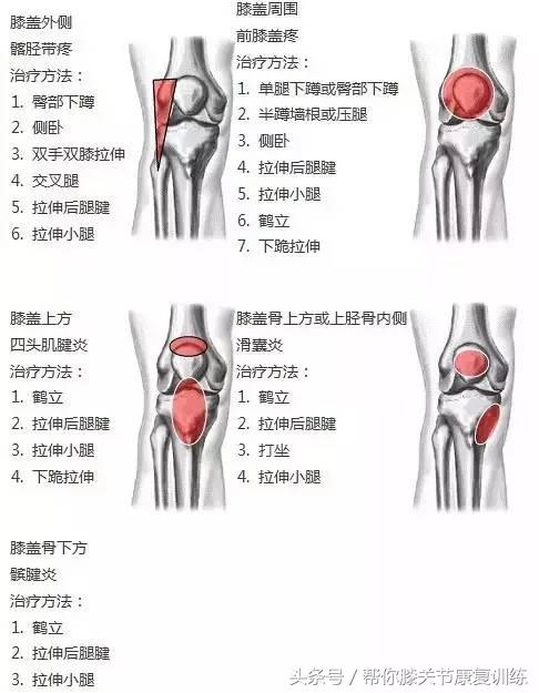 长沙洪山骨科王加升主任 膝盖不同位置的疼痛代表不同疾病,你造吗