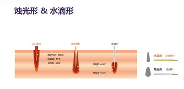 微针只能用一次吗