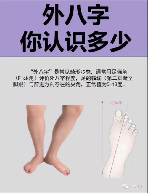 形成原因和运动矫正