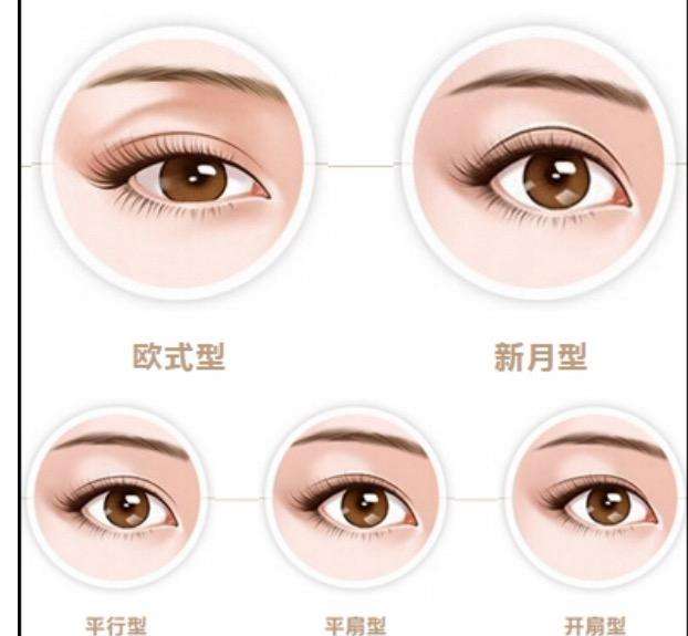 韩式双眼皮效果如何 与欧式双眼皮区别在哪