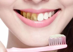 为什么会牙齿发黄 主要与这3大因素有关