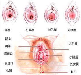 剖析：丁丁具体在哪顶开处女膜