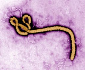 埃博拉病毒(哪些国家曾发生过埃博拉病毒)