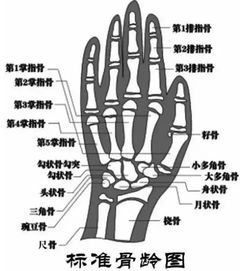 骨龄与身高的关系密不可分 儿科主任郑荣秀为您解读