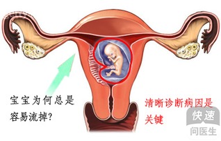 怀孕10周，检查的先兆流产。保胎能保吗