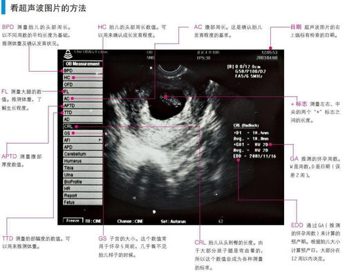 怀孕不易,做好功课是前提 一书在手,孕期无忧