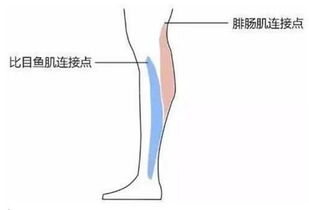 小腿粗壮不能怪跑步 两条肌肉决定你的小腿外观 