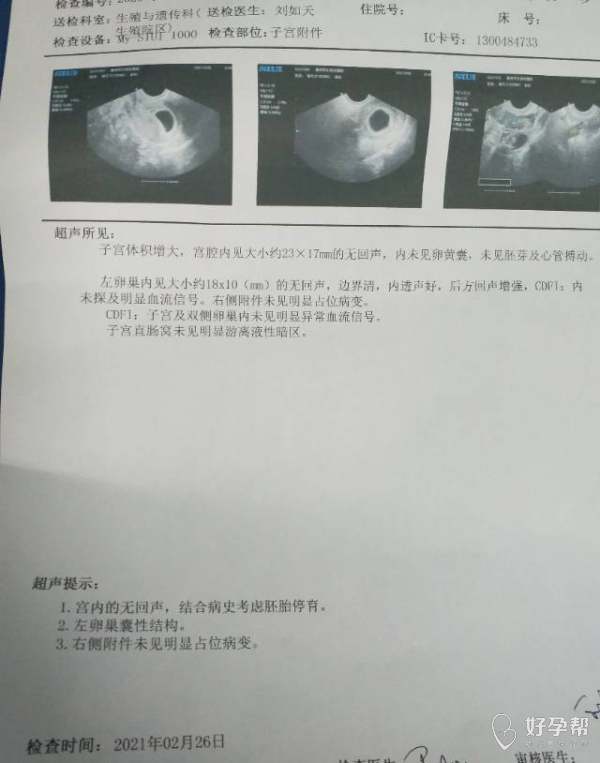 B超检查对胎儿有无伤害