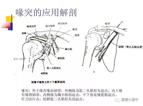 专业 Maitland手法治疗肩周炎,详细图文 