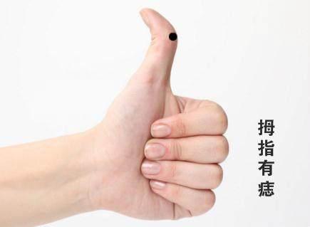 手指长痣的命运 每个指头代表什么,你知道吗 