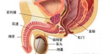 如何治疗男性睾丸炎才能最有效呢